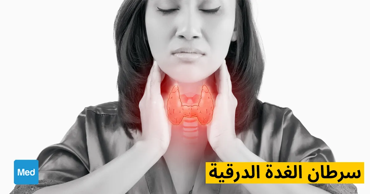 سرطان الغدة الدرقية